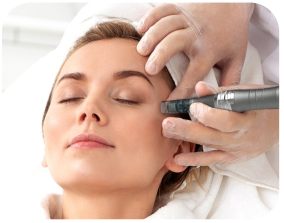 Microneedle áp lực âm