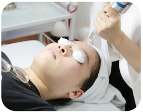Laser Fractional CO2