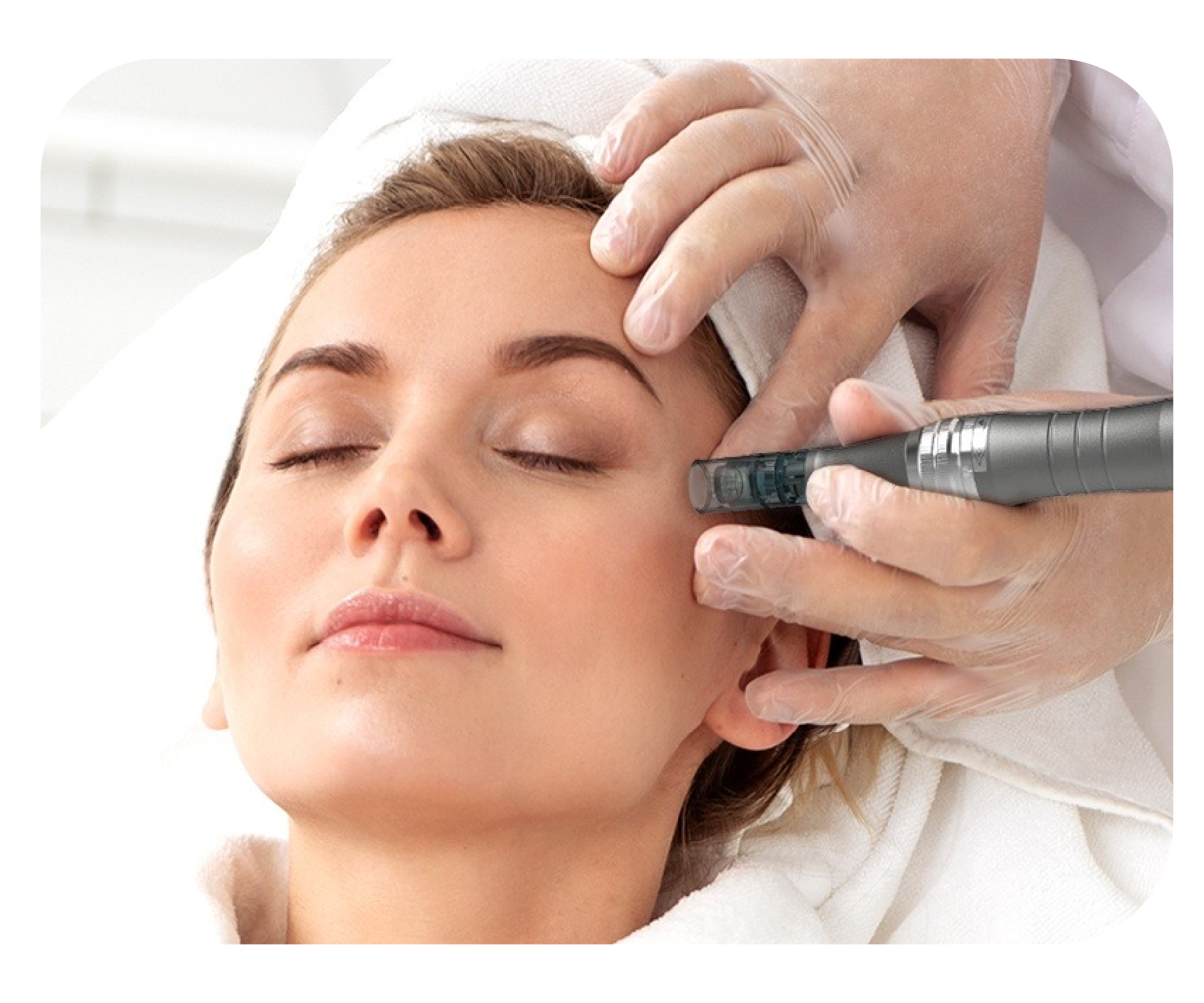 Microneedle áp lực âm